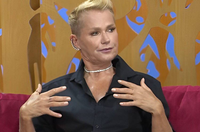  Xuxa revela paralisia que sofreu após cirurgia plástica sem consentimento: ‘Me encheu de fibrose’