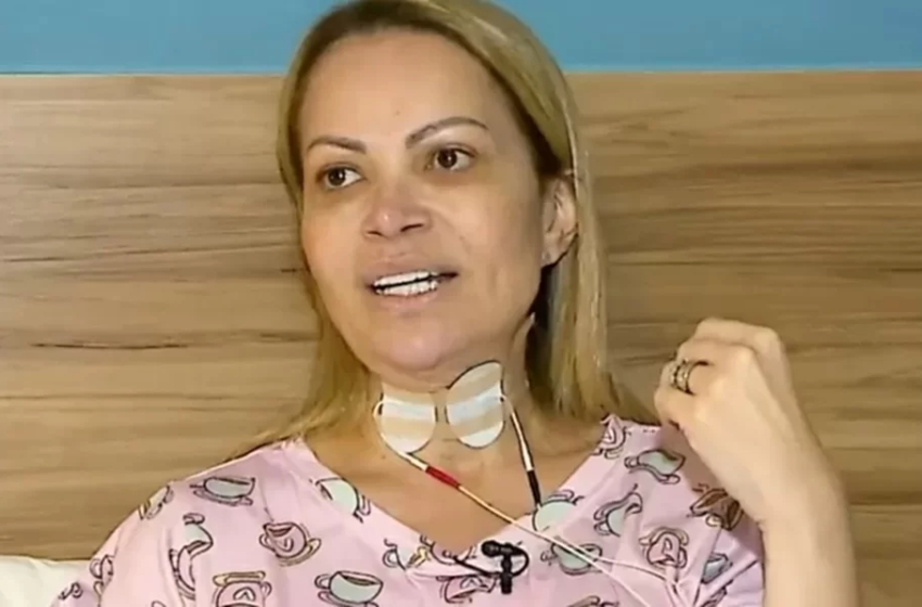  Solange Almeida revela lesões por uso de cigarro eletrônico